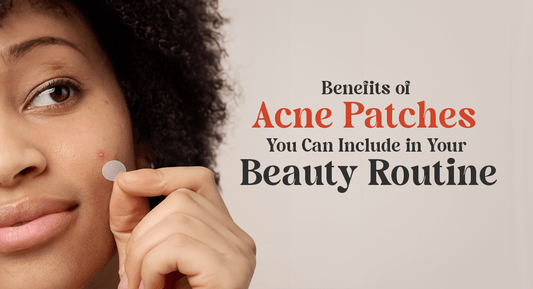 10 Benefits of Acne Patches You Can Include in Your Beauty Routine