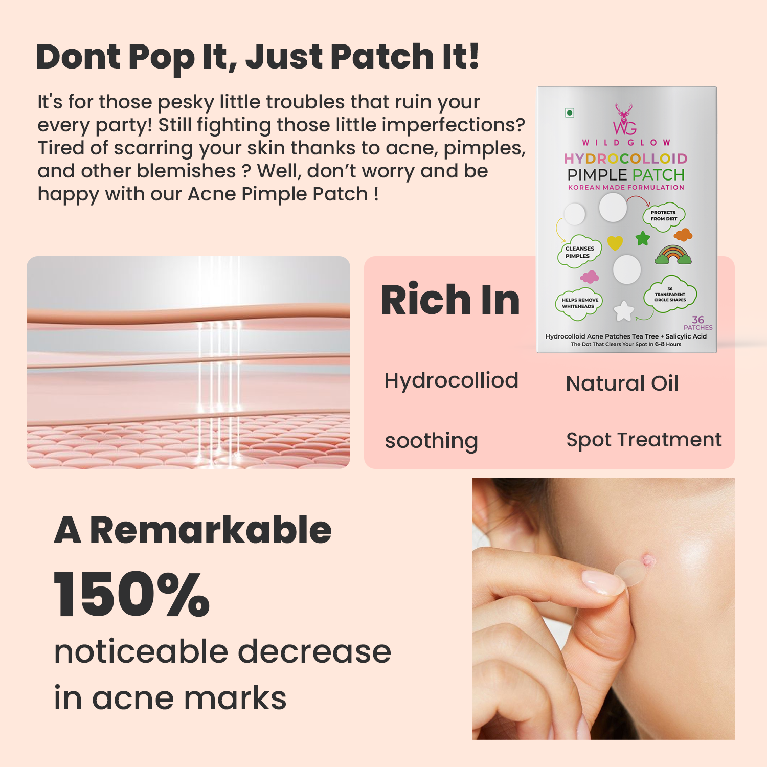 Night Clear Acne Hydrocolloid Patches