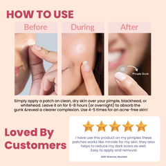 Night Clear Acne Hydrocolloid Patches