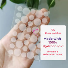 Overnight Acne Relief Hydrocolloid Pimple Patches With Salicylic Acid - 36 Dots