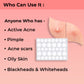 Overnight Acne Relief Hydrocolloid Pimple Patches With Salicylic Acid